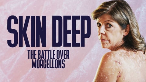 Skin Deep: The Battle Over Morgellons cover image