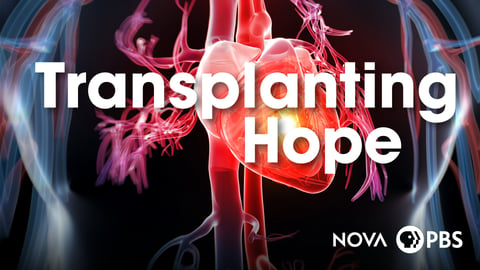 Transplanting Hope cover image